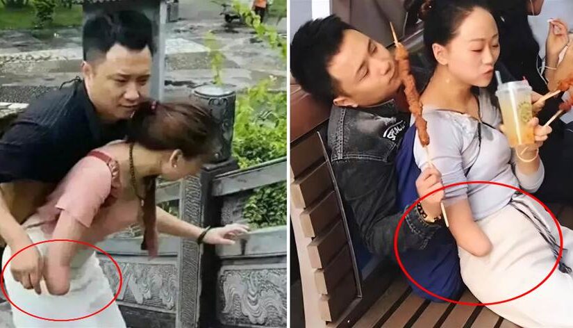 網紅「連體夫妻」：「無腿」丈夫劈腿女粉絲，「獨臂」妻帶娃離開後怎樣了